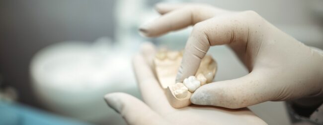 Dental Crowns and Bridges are two popular options that Adelaide, Gum Disease, Gum Disease Early Sign, Gum Disease Prevention, Gum Disease Treatment