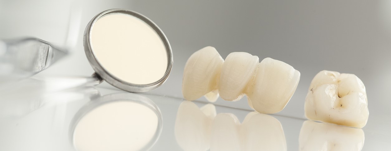 Dental Crowns and Bridges is best made in consultation with your experienced Adelaide Dentist.
