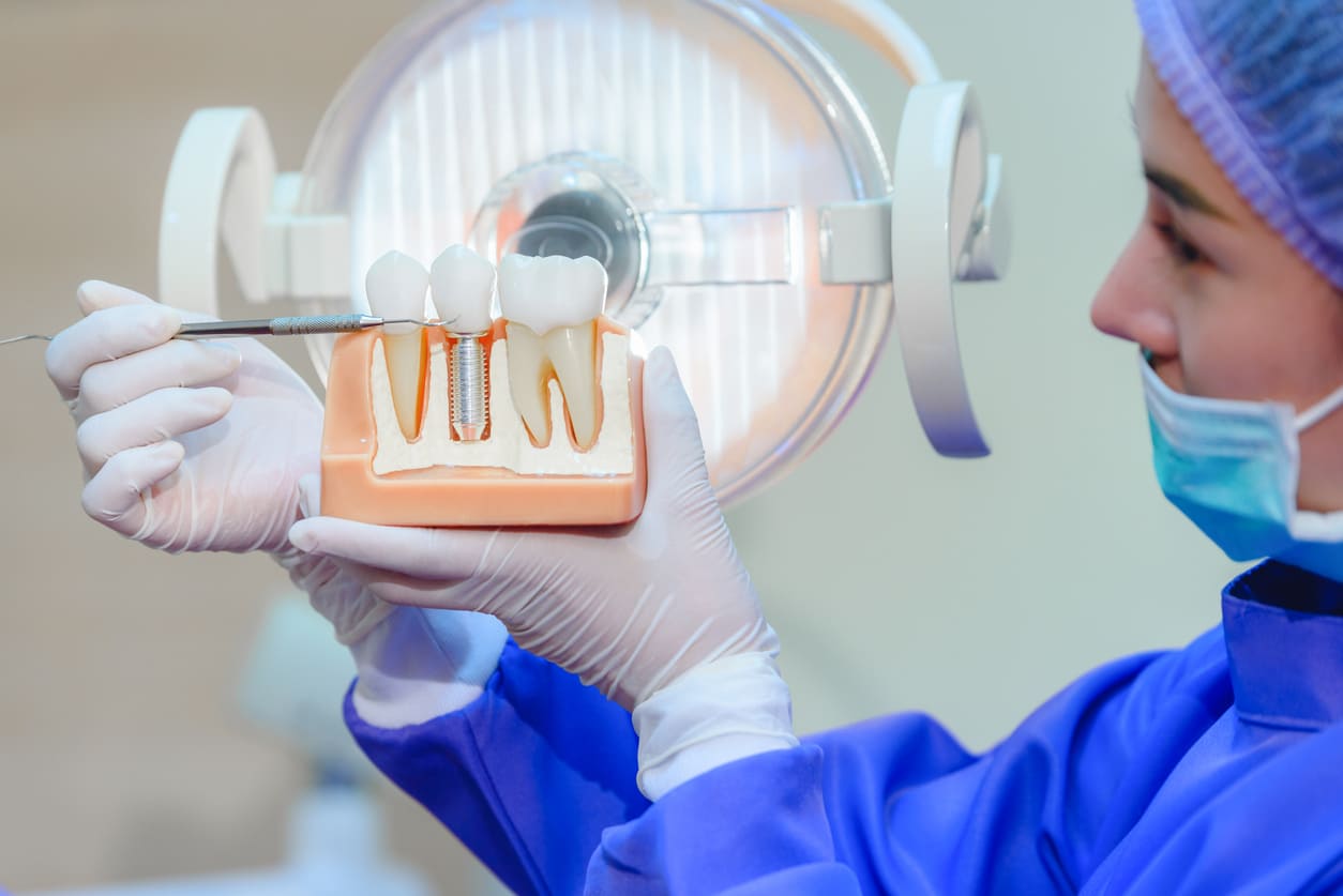 What Sets Adelaide DentalCare Apart for Dental Implants